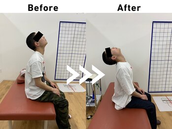 てあつい整体院 下松院/肩こり