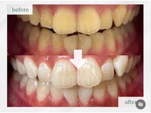 エマ 大橋店(emma)/20代学生