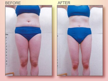 ジュリア オージェ 梅田店/ビフォーアフター(ターゲット)