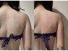 【上半身集中】バキバキ肩と辛い頭痛に…天使の羽♪　初回¥12,500 90分