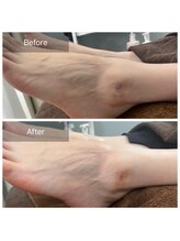 トニック バイ まつもと整骨院鍼灸院(Tonic)/★ピーリング&美容液★