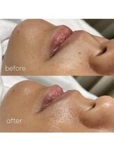 ララアイラッシュ(lala eyelash)/