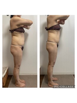 インディバアンドリンパサロン シエスタ(siesta)/