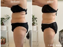 ウル(Ulu)/腸もみビフォーアフター