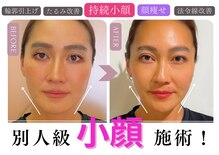 ヴィヴィアナ(viviana)