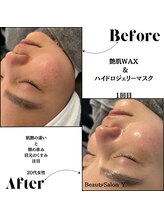 ワイドット(Y.)/うるおいで艶が戻ってきた