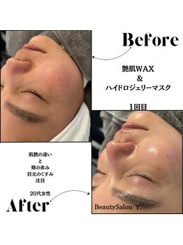 ワイドット(Y.)/うるおいで艶が戻ってきた