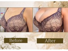 マリン(MARINE)/Before→After