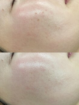 ルミナ シブヤ(LUMINA SHIBUYA)/Before→After