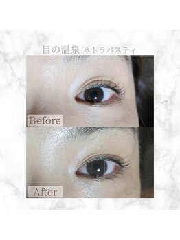 クロレ(Colorer)/ネトラバ