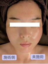 ボディーワークスナビ(Body Works Navi)/小顔矯正コルギ＆レモンボトル