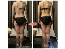 エステティックサロン リアン(Lien)/下半身痩せのお客様