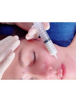 お肌をきれいにしたい