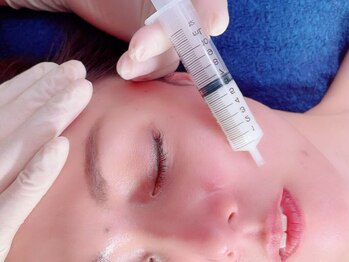 パシュの写真/何をしても変わらない深い肌悩みに!角質毛穴洗浄×ヒト幹細胞×スピキュールでワンランク上の滑らか素肌に!