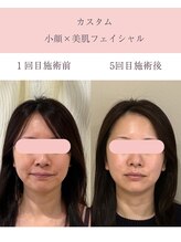 シンナリ(Shinnari)/カスタム小顔×美肌フェイシャル