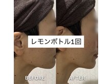 ヴィヴ 三島店(Vive)/《レモンボトル》