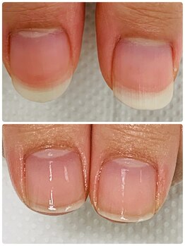 カルカルフット アンド カルネイルサロン(Karu karu foot & Karu nail salon)/ケアで育成【3ヶ月コース】