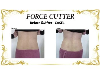 シェリラソワン(Che'rie La Soin)/ビフォーアフター