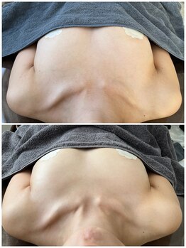 モア(moa)/授乳後の頑張ったバストも◎