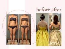 ミチ 整体サロン(michi)/ブライダルハイパーナイフも人気