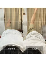 ナオル整体 池袋院(NAORU整体)/骨盤のねじれを調整！【池袋】