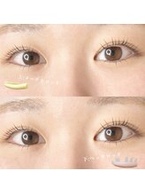 リアイズ(Re Eyes)/上下まつ毛パーマ