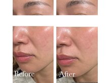 MMK/光を味方にピカーン発光モテ肌☆