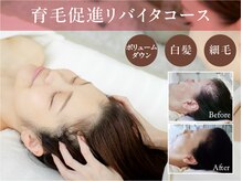イーズ 武蔵小杉店の雰囲気（結果にこだわる育毛促進＆頭皮ケア）