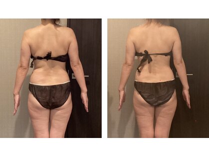 ブリス(bliss)の写真