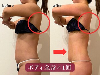 クレンズ(CLeanse)/40代ボディ全身105分体験の変化