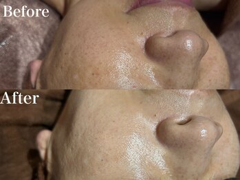 ディアーム 光明池店(Diarm)/陶肌ピール