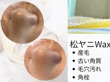アンベリール(Embellir)