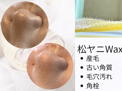 アンベリール(Embellir)の写真