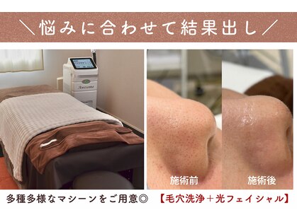 ウミン(UMIN)の写真