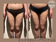 アムール 麻布十番(Amour)/エンダモロジーアライアンス