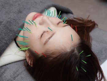 キクキク(KIKUKIKU)/オーダーメイド美容鍼