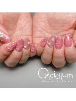 オンシジューム(Oncidium)/お花×フラッシュネイル