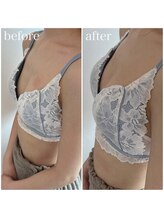 リノ 行橋(lino)/◇バストアップ症例◇20代