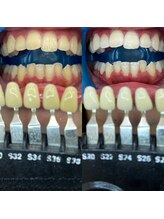 トウキョウスワーズ 池袋店(TOKYO SWRS)/#ホワイトニング #池袋 #渋谷