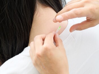 佐藤鍼灸院 美顔鍼プレム(美顔鍼PUREMU)/首、肩の施術3