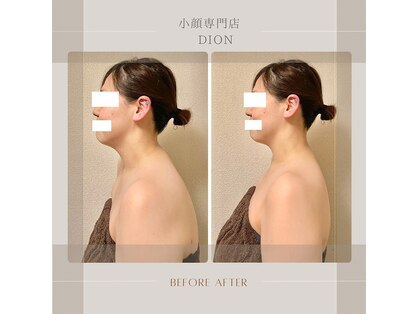 ディオン(Dion)の写真