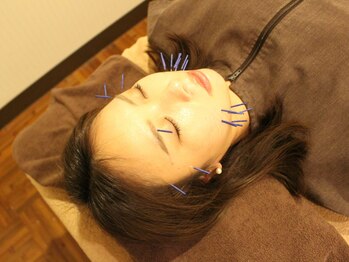 あいのて 国立店の写真/《リフトUP美容鍼+養生鍼灸90分¥15000→¥7300》お顔～身体までトータルケア！国立駅2分★口コミ高評価