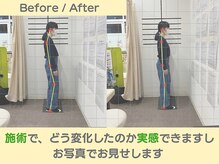 おいかわ整骨院/目で見てわかる施術変化
