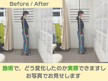 おいかわ整骨院/目で見てわかる施術変化