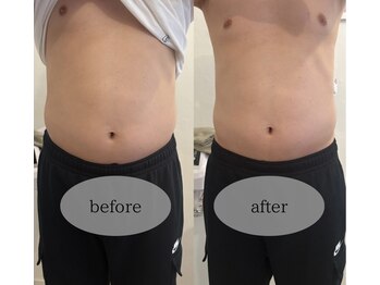 マホロバ セカンド(mahoroba 2nd)/メンズにも人気腸マッサージ