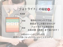 リモア(REMORE)/フォトライトの秘密！