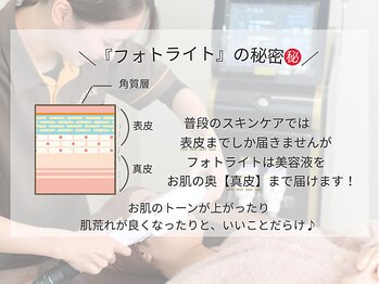 リモア(REMORE)/フォトライトの秘密！