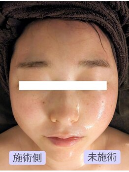 ボディーワークスナビ(Body Works Navi)/小顔矯正コルギ＆レモンボトル