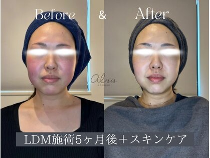 アイシス(AIsis)の写真