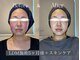 アイシス(AIsis)の写真